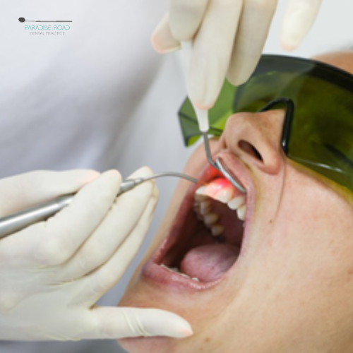 Laser Dentistry in Newlands