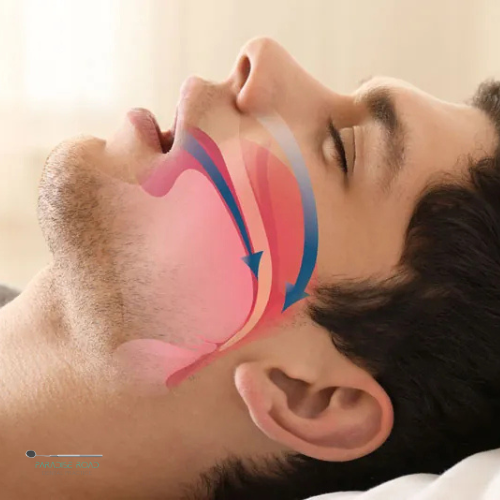 Sleep & Airway Dentistry at Paradise Dental Practice in Newlands